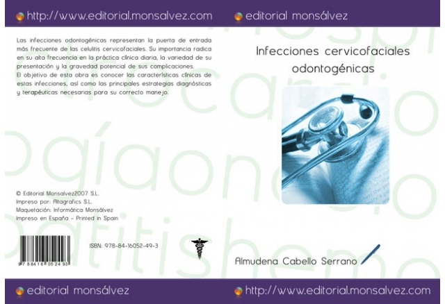Infecciones cervicofaciales odontogénicas