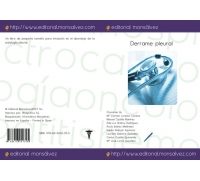 Derrame pleural