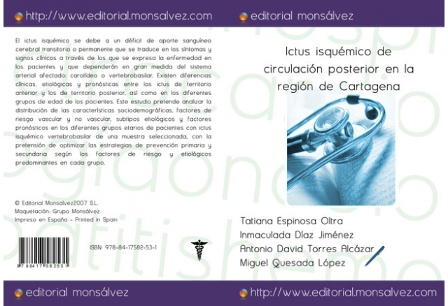 Ictus isquémico de circulación posterior en la región de Cartagena