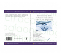 Manifestaciones de la insuficiencia renal crónica sobre la piel del paciente