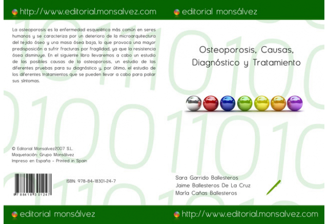 Osteoporosis, Causas, Diagnóstico y Tratamiento