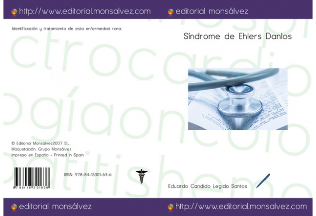 Síndrome de Ehlers Danlos