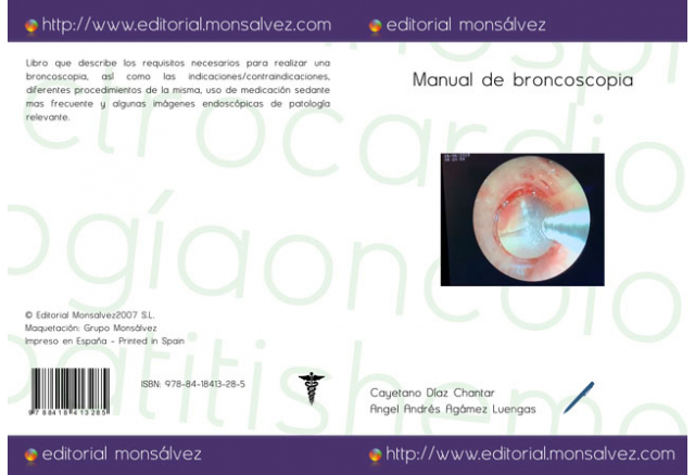 Manual de broncoscopia