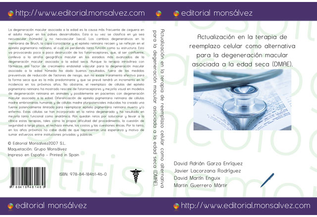 Actualización en la terapia de reemplazo celular como alternativa para la degeneración macular asociada a la edad seca (DMAE).