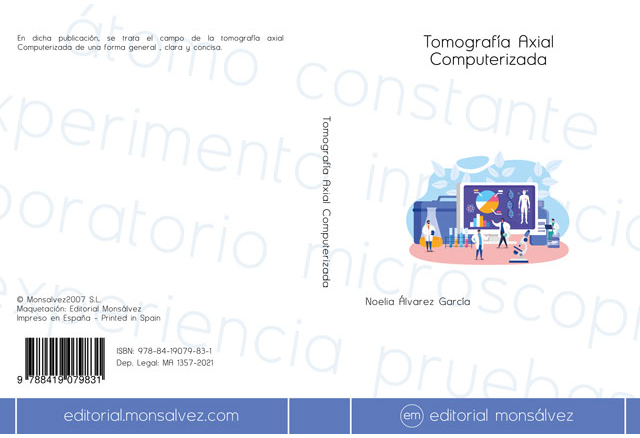 Tomografía Axial Computerizada