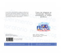Casos de imágenes en hematología: Hallazgos morfológicos en sangre periférica