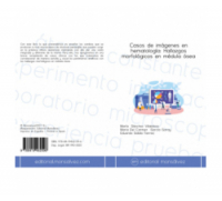 Casos de imágenes en hematología: Hallazgos morfológicos en médula ósea