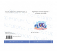 Implantes dentales frente a prótesis removible