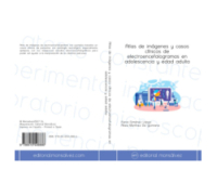 Atlas de imágenes y casos clínicos de electroencefalogramas en adolescencia y edad adulta