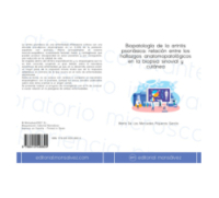 Biopatología de la artritis psoriásica: relación entre los hallazgos anatomopatológicos en la biopsia sinovial y cutánea