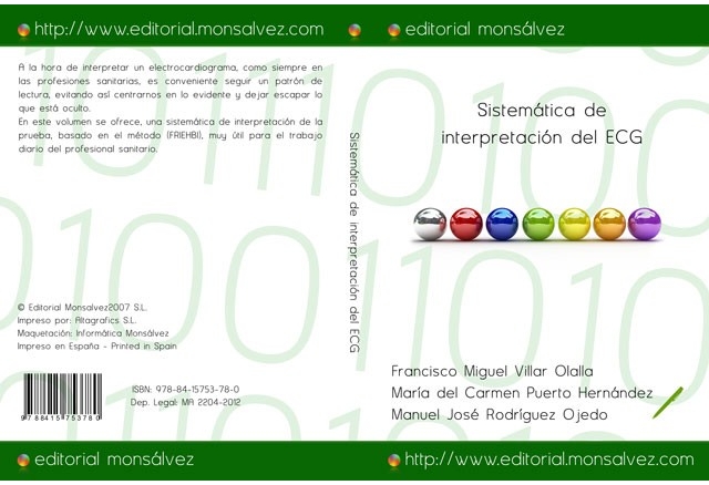Sistemática de interpretación del ECG