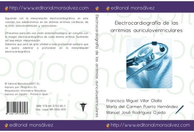 Electrocardiografía de las arritmias auriculoventriculares