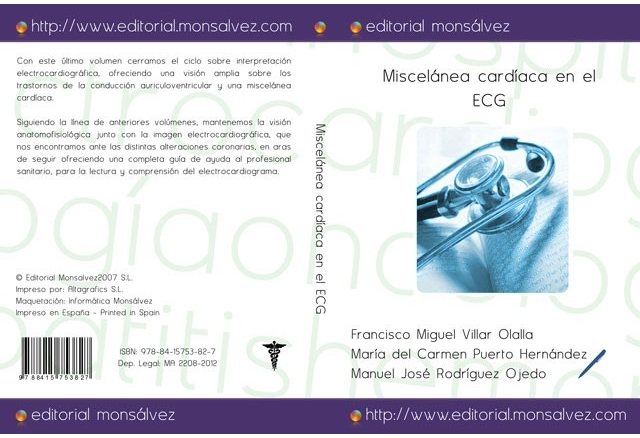 Miscelánea cardíaca en el ECG
