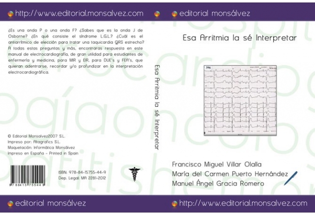 Esa Arritmia la sé Interpretar